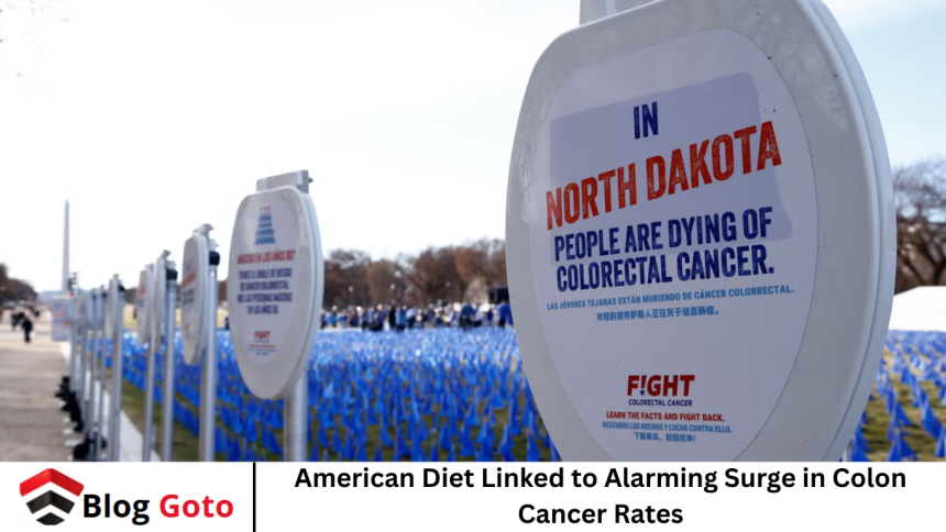 American Diet Linked to Alarming Surge in Colon Cancer Rates