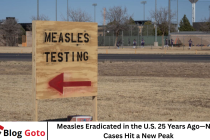 Measles Eradicated in the U.S. 25 Years Ago—Now Cases Hit a New Peak