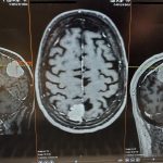 MRI scan of a human brain