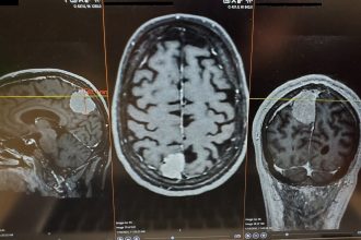 MRI scan of a human brain