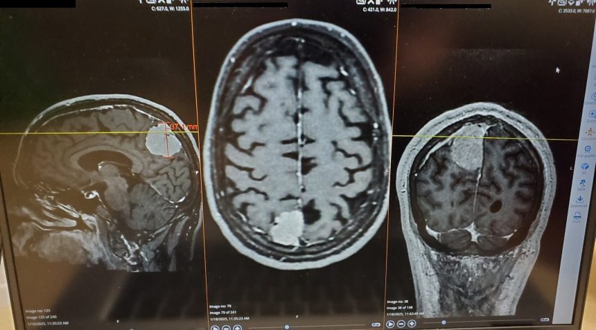 MRI scan of a human brain